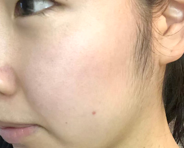 マトリックスエキス　お試し　navis 12日目②